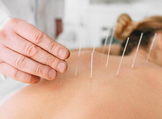 Exploration des Thérapies Complémentaires : De l'Acupuncture à la Zoothérapie - Santé gourmet Image
